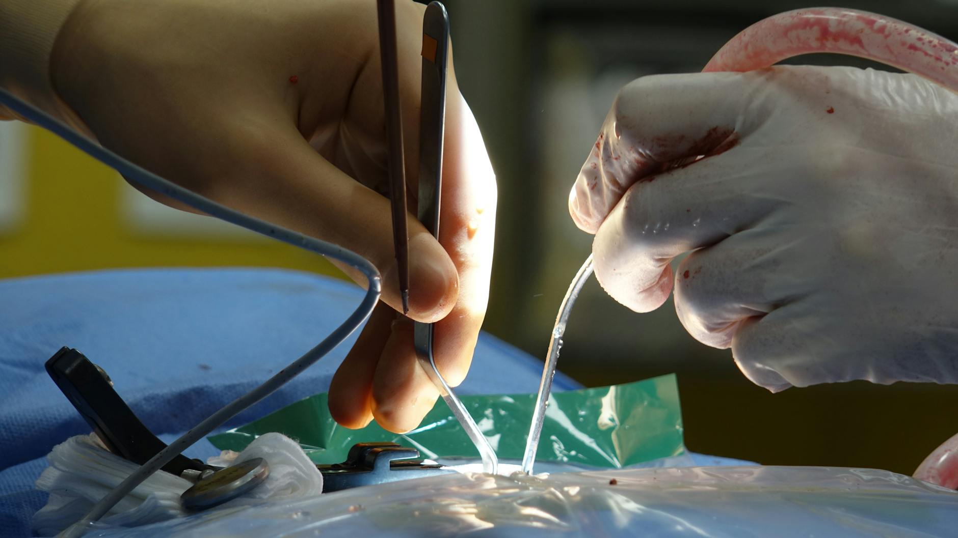 Peste 150 de operatii pe an pentru un neurochirurg roman acreditat ca Master Surgeon