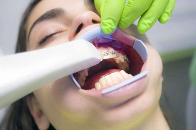 din 2026 dentist fara bani prin cnas ce tratamente sunt acoperite gratuit